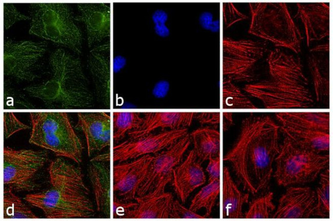 Mouse IgG F(ab')2 Secondary Antibody in Immunocytochemistry (ICC/IF)