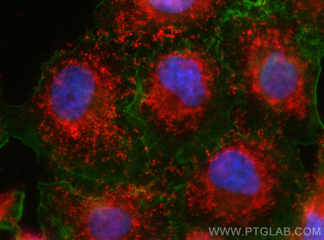 LYRM5 Antibody in Immunocytochemistry (ICC/IF)