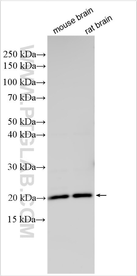 HOXB5 Antibody in Western Blot (WB)
