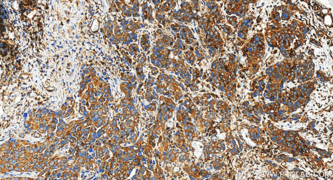 FYB Antibody in Immunohistochemistry (Paraffin) (IHC (P))