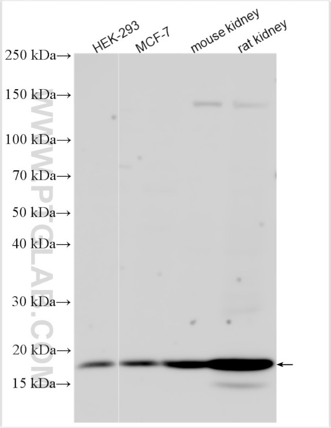 NUDT4 Antibody in Western Blot (WB)