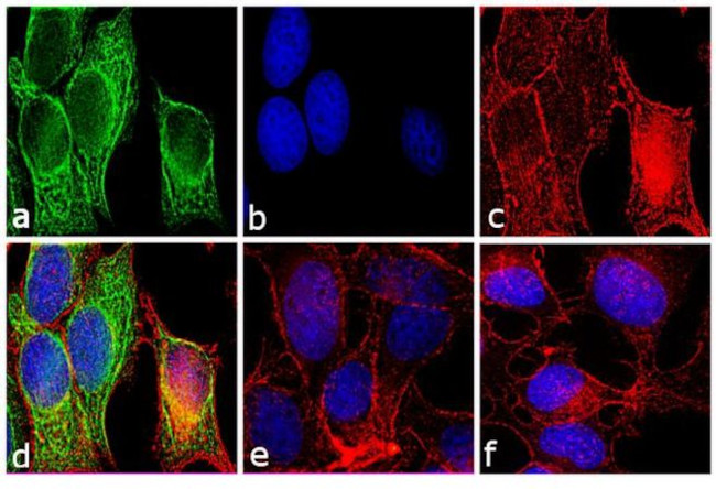 Mouse IgG F(ab')2 Secondary Antibody in Immunocytochemistry (ICC/IF)