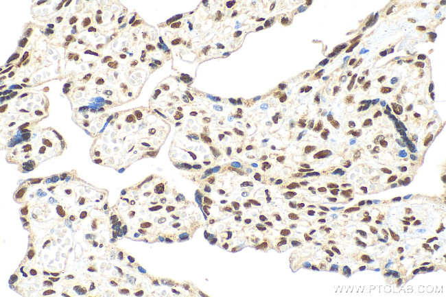BOD1L Antibody in Immunohistochemistry (Paraffin) (IHC (P))