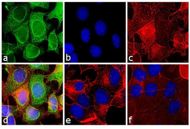 Mouse IgG (H+L) Secondary Antibody in Immunocytochemistry (ICC/IF)