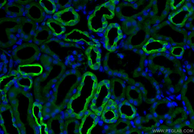 AIF1L Antibody in Immunohistochemistry (Paraffin) (IHC (P))