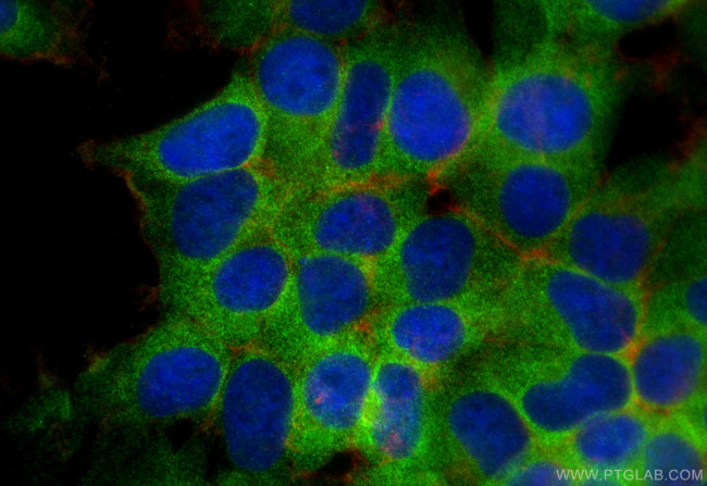 UNK Antibody in Immunocytochemistry (ICC/IF)