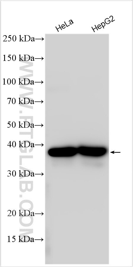 DNAJC17 Antibody in Western Blot (WB)