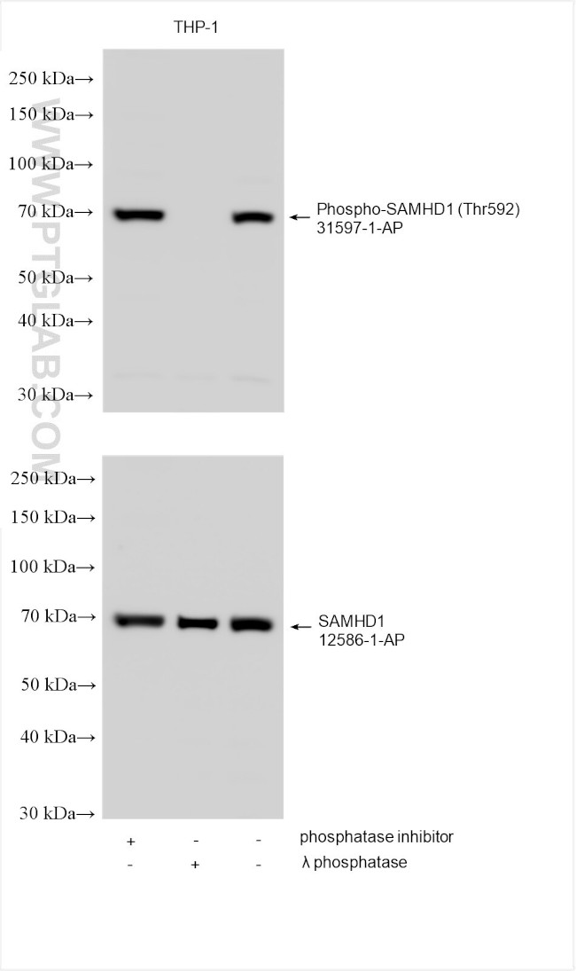 RBKS Antibody in Western Blot (WB)