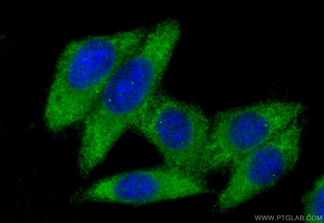 F2 Antibody in Immunocytochemistry (ICC/IF)