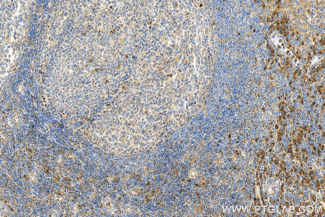 VISTA Antibody in Immunohistochemistry (Paraffin) (IHC (P))