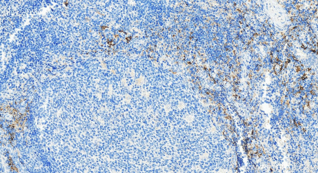 CD209 Antibody in Immunohistochemistry (Paraffin) (IHC (P))