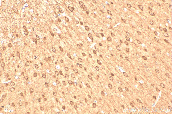 EFHD2 Antibody in Immunohistochemistry (Paraffin) (IHC (P))