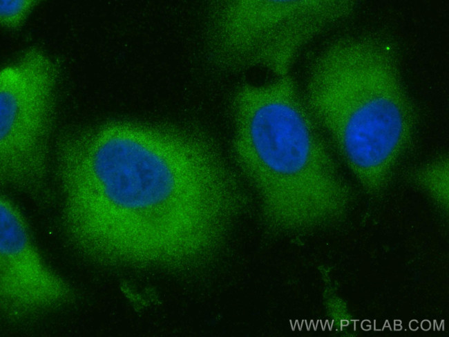 NPEPPS Antibody in Immunocytochemistry (ICC/IF)