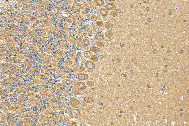 FRMPD3 Antibody in Immunohistochemistry (Paraffin) (IHC (P))