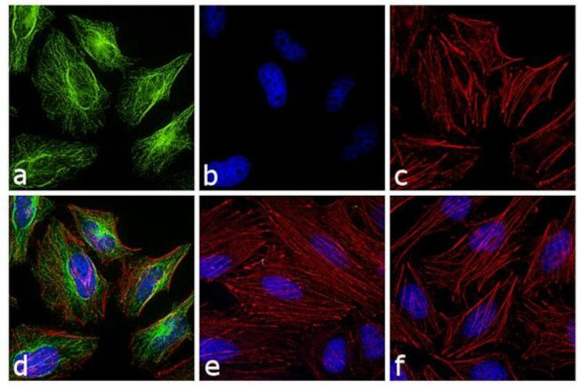 Rabbit IgG (H+L) Cross-Adsorbed Secondary Antibody in Immunocytochemistry (ICC/IF)