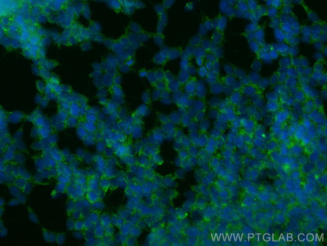 TMEM151A Antibody in Immunocytochemistry (ICC/IF)