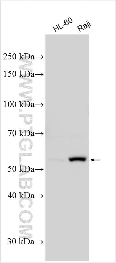 FGR Antibody in Western Blot (WB)