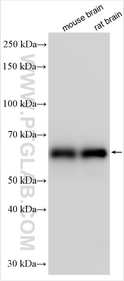 CACNB3 Antibody in Western Blot (WB)