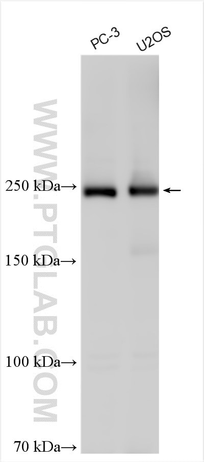 dysferlin Antibody in Western Blot (WB)