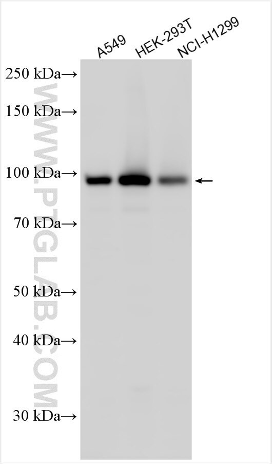 CHML Antibody in Western Blot (WB)