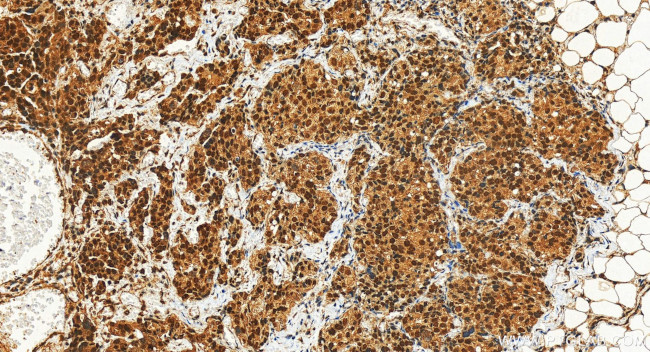 INTS6 Antibody in Immunohistochemistry (Paraffin) (IHC (P))