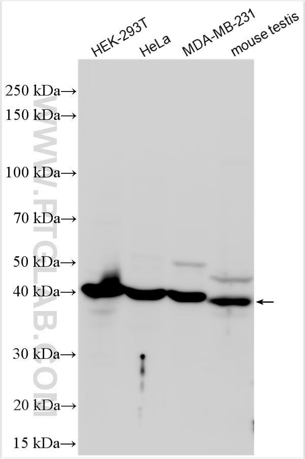 RAD51C Antibody in Western Blot (WB)