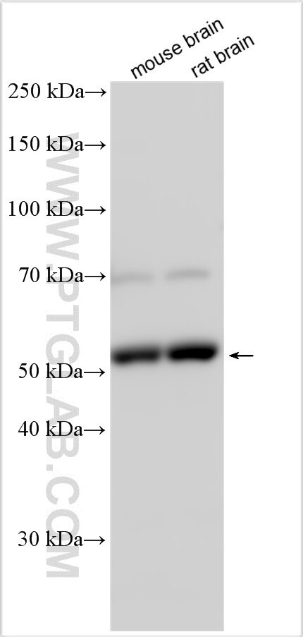 CCDC151 Antibody in Western Blot (WB)
