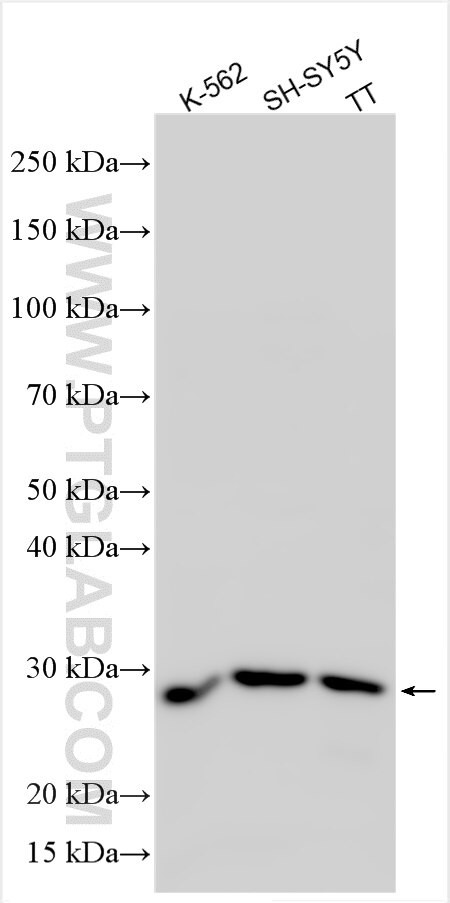 TMEM151B Antibody in Western Blot (WB)