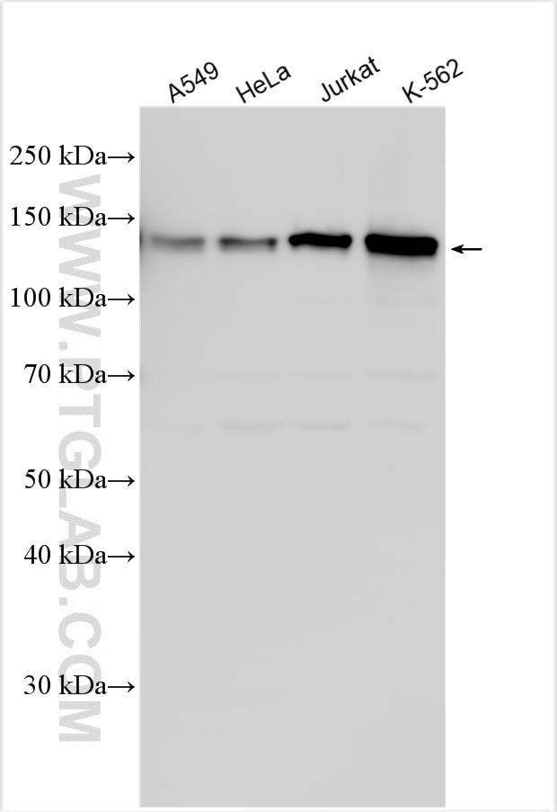 CIZ1 Antibody in Western Blot (WB)