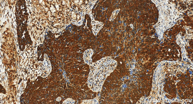 ARFGEF1 Antibody in Immunohistochemistry (Paraffin) (IHC (P))