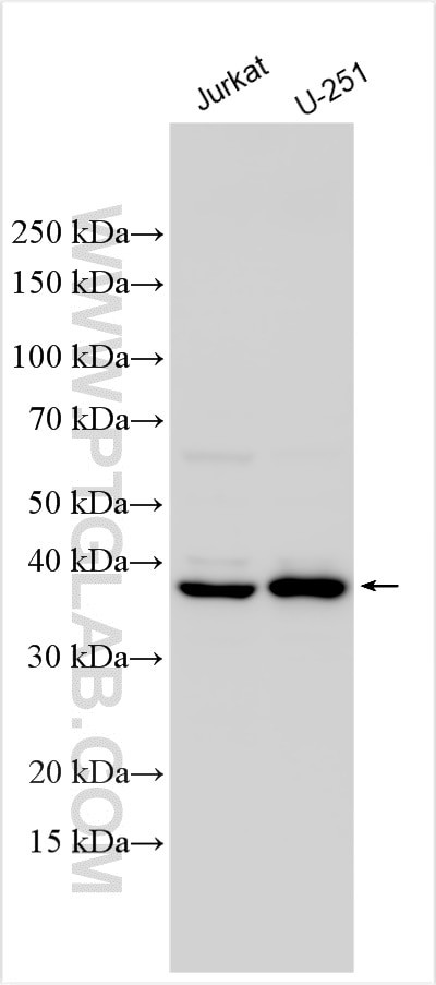ALAD Antibody in Western Blot (WB)
