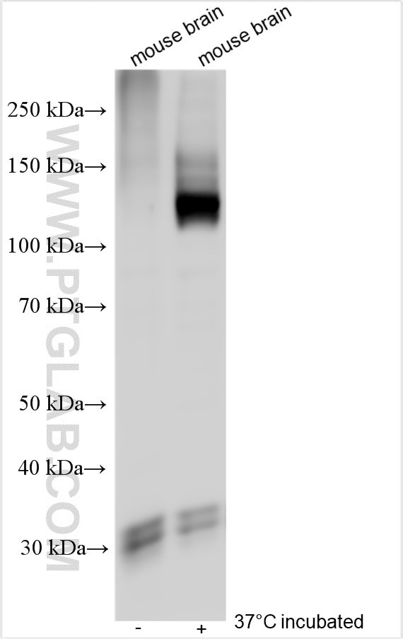 ATP2B3/PMCA3 Antibody in Western Blot (WB)