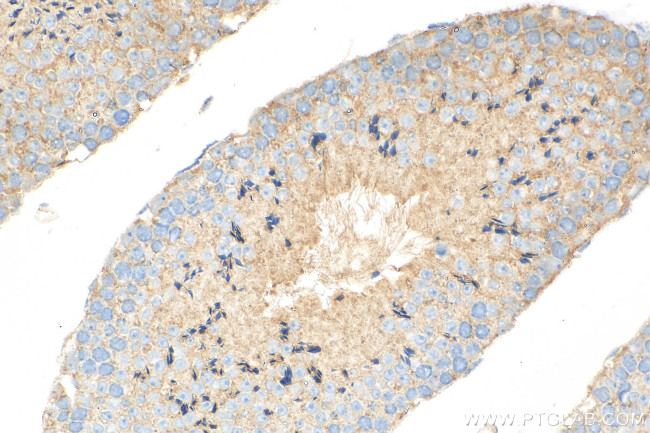 ATP8A2 Antibody in Immunohistochemistry (Paraffin) (IHC (P))