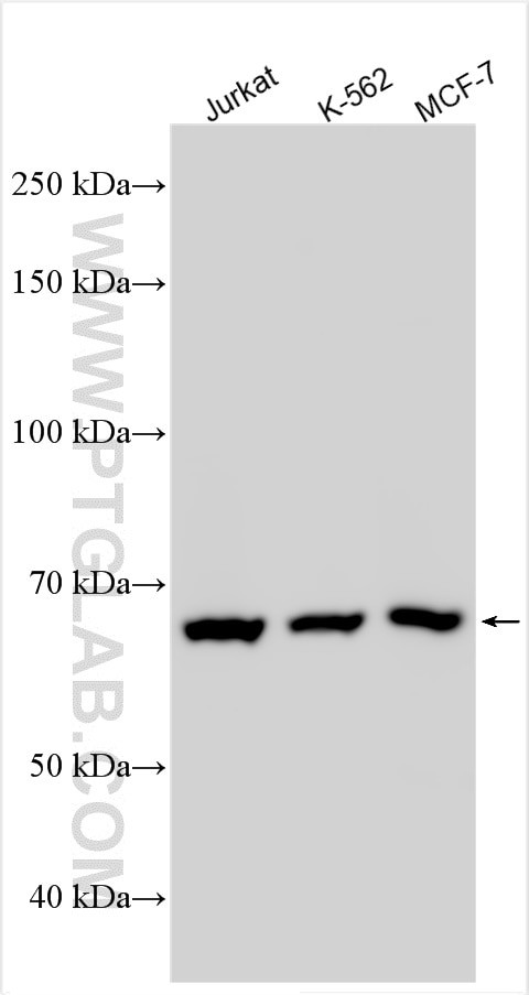 CWF19L1 Antibody in Western Blot (WB)