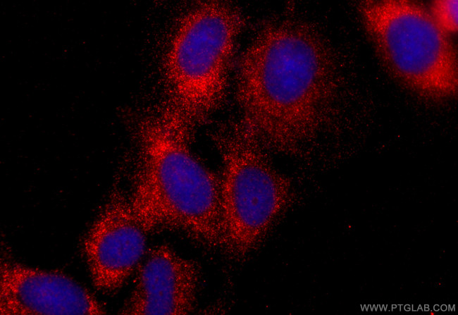 CSDA Antibody in Immunocytochemistry (ICC/IF)