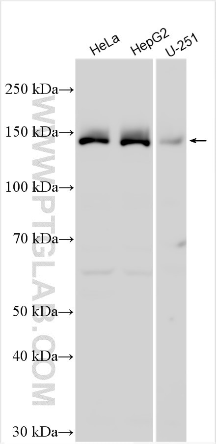 IKBKAP Antibody in Western Blot (WB)
