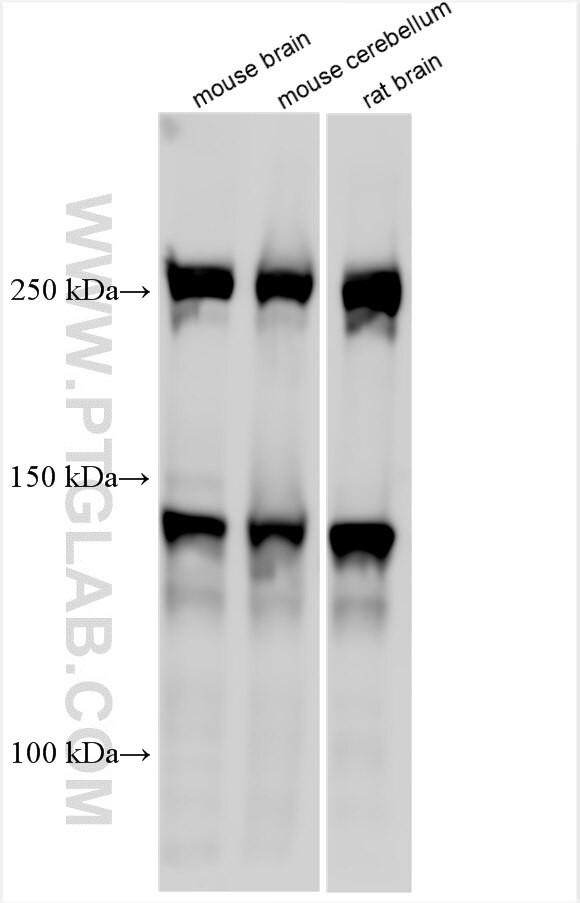SPTBN4 Antibody in Western Blot (WB)