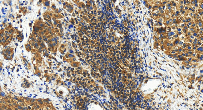 LDAH Antibody in Immunohistochemistry (Paraffin) (IHC (P))