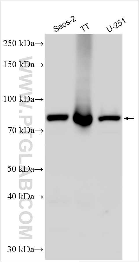 KBTBD6 Antibody in Western Blot (WB)