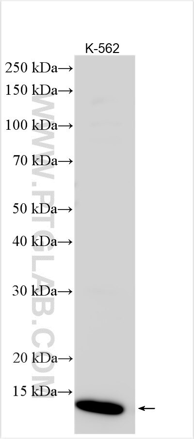 HBG2 Antibody in Western Blot (WB)