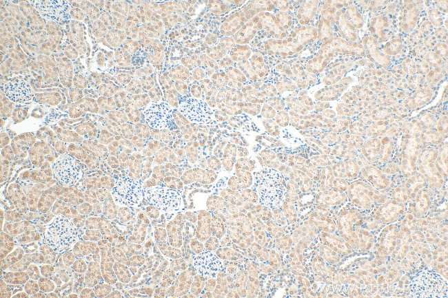 Osteoprotegerin/TNFRSF11B Antibody in Immunohistochemistry (Paraffin) (IHC (P))