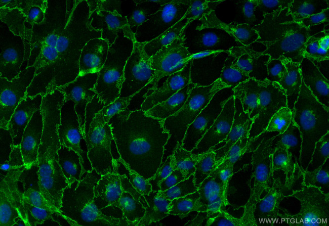 VE-cadherin/CD144 Antibody in Immunocytochemistry (ICC/IF)