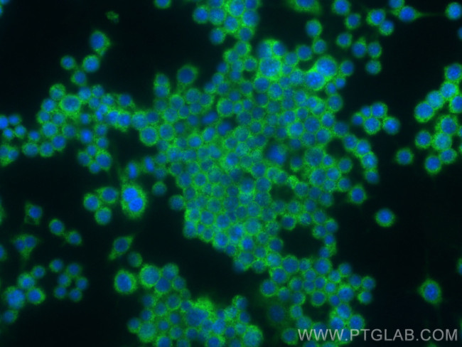 GPR112 Antibody in Immunocytochemistry (ICC/IF)