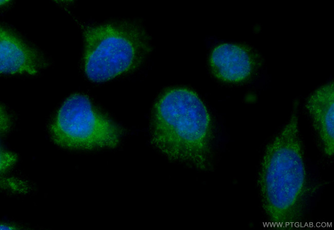 ENGASE Antibody in Immunocytochemistry (ICC/IF)