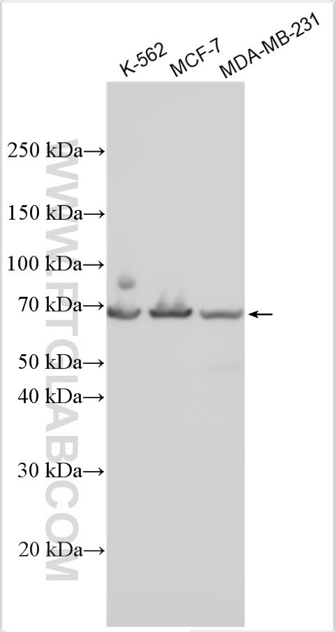 BRWD3 Antibody in Western Blot (WB)