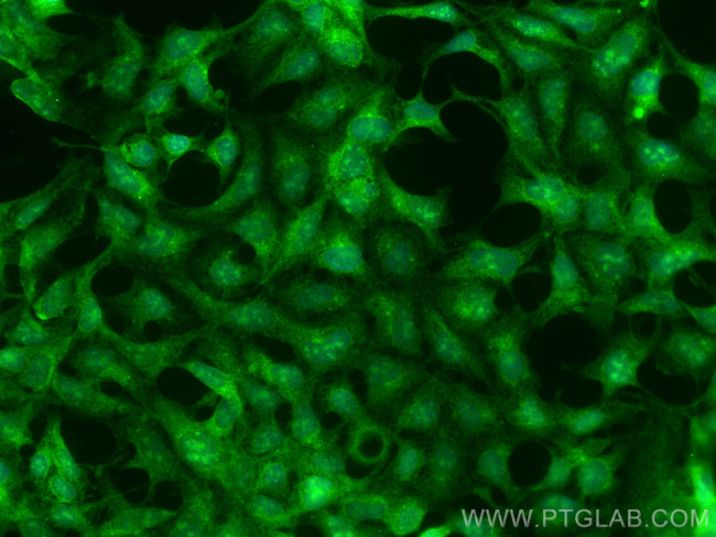 LIAT1 Antibody in Immunocytochemistry (ICC/IF)