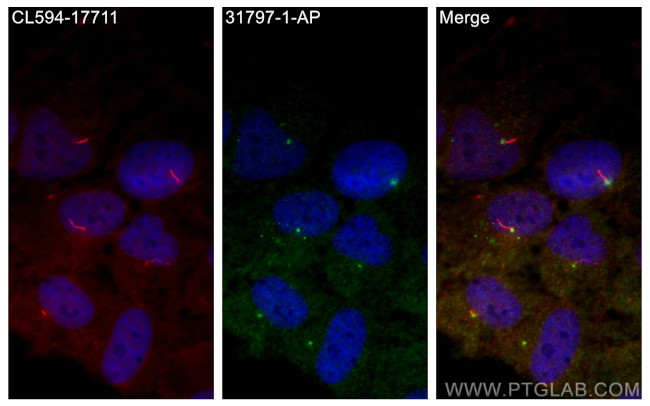 TTC9C Antibody in Immunocytochemistry (ICC/IF)