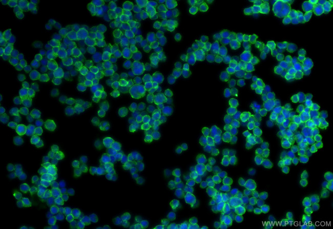 CD2 Antibody in Immunocytochemistry (ICC/IF)