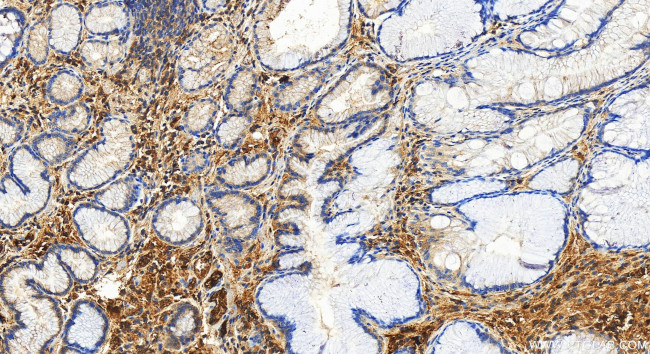 Serum amyloid P component Antibody in Immunohistochemistry (Paraffin) (IHC (P))