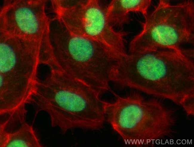IK Antibody in Immunocytochemistry (ICC/IF)